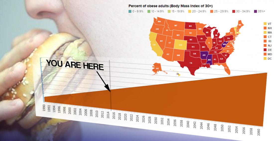 Today's Kids May Live Shorter Lives than Their Parents
