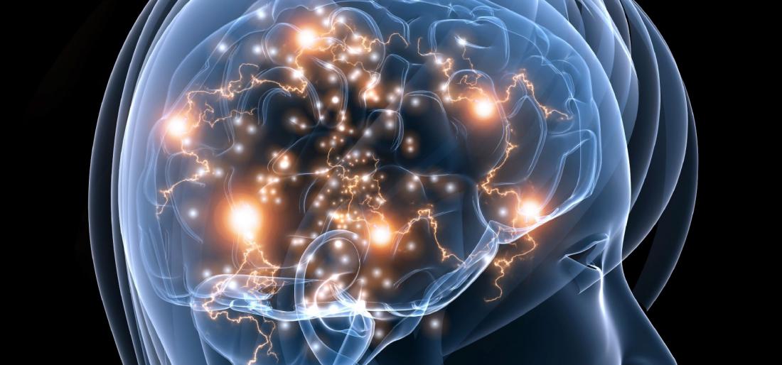 How Exercise Affects Your Brain